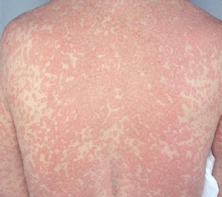Viagra can i take viagra while on antidepressants medication